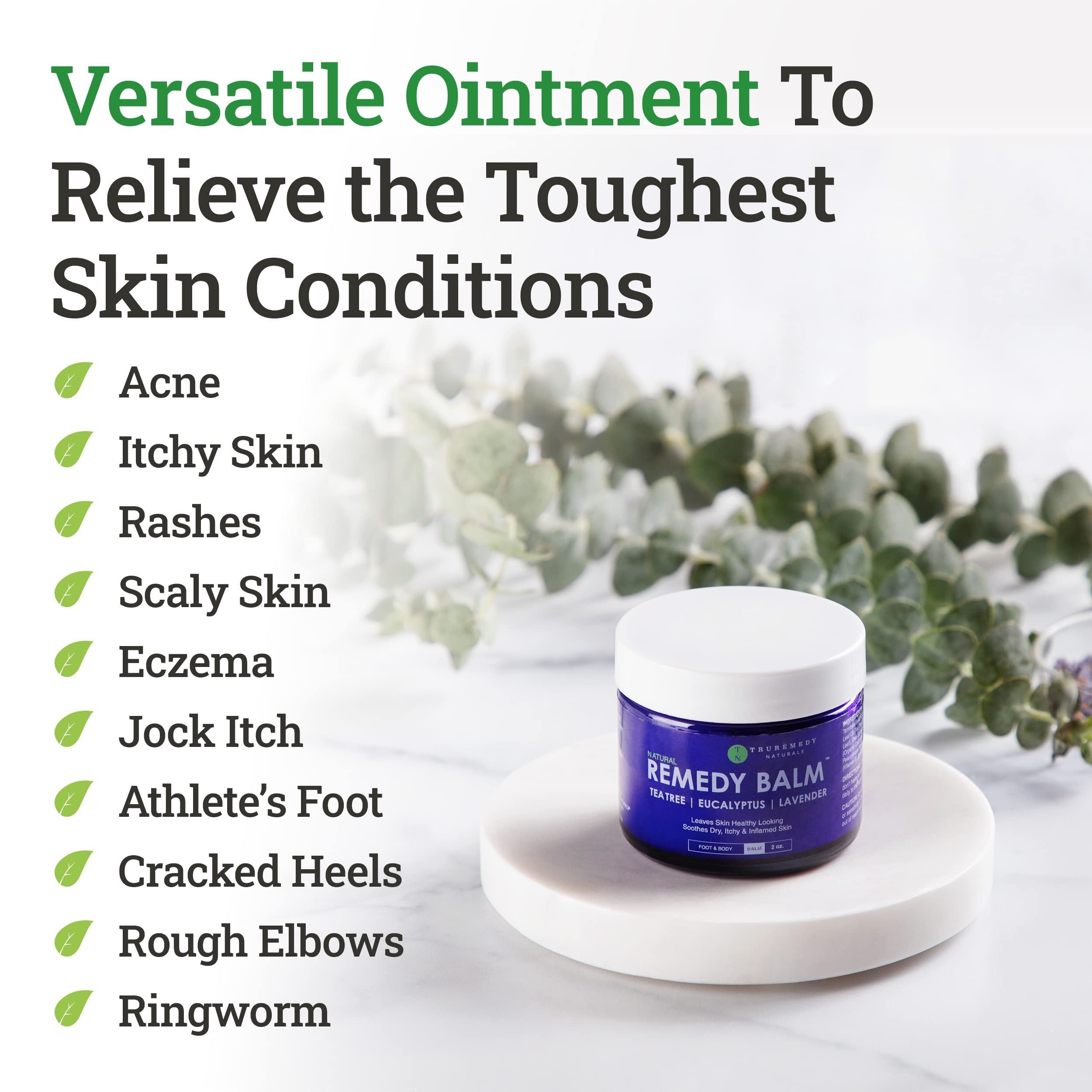 Truremedy Naturals Tea Tree Oil Balm 2oz - Athlete's Foot, Jock Itch, Eczema, Skin Irritation Relief - Lavender & Eucalyptus - Blue
